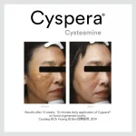 Cyspera® Intensive Duo (NEW) - Image 3