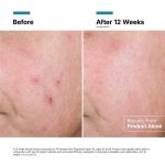 SkinCeuticals Advanced RGN-6 - Image 7